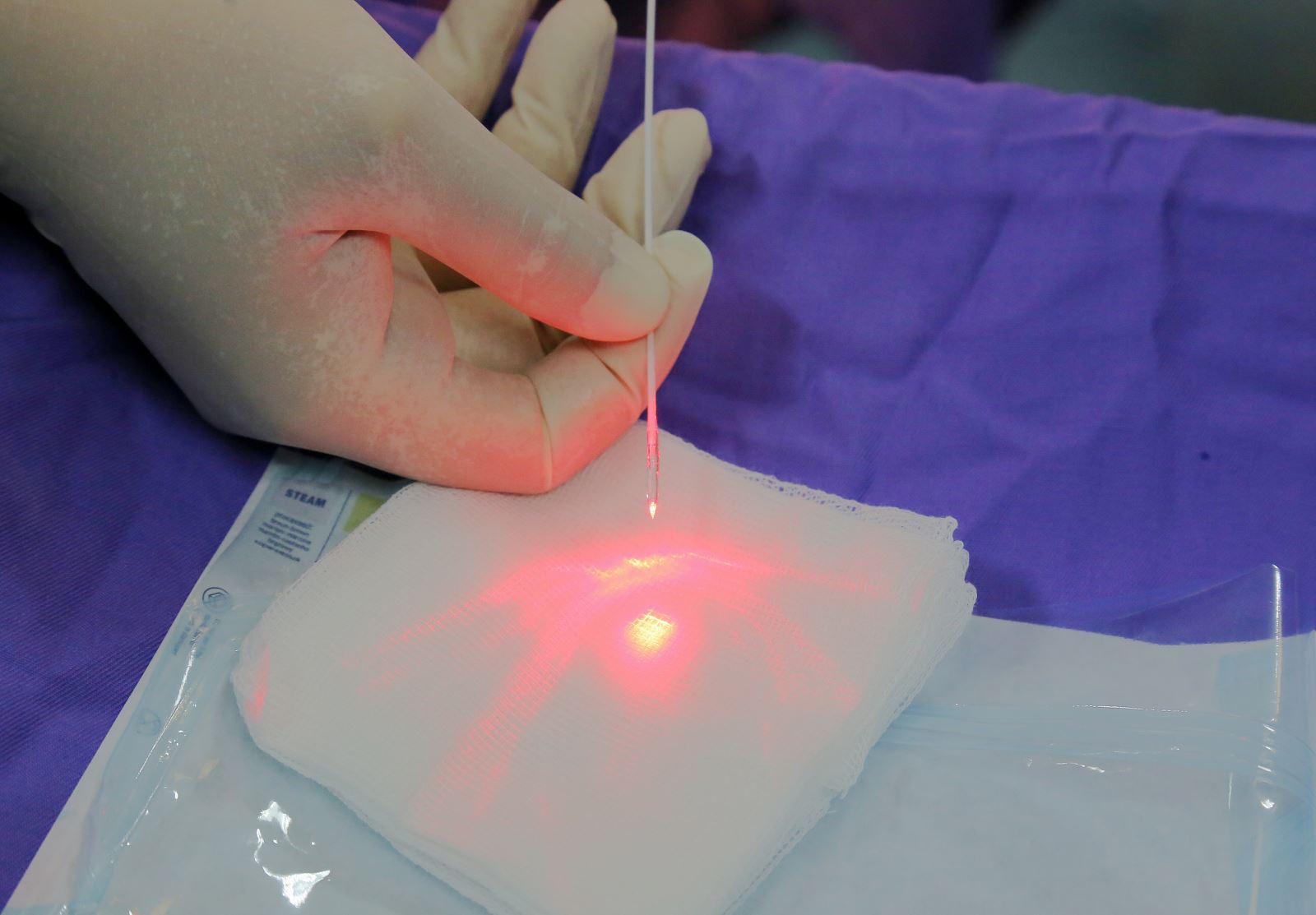 Vì sao nhiều người chọn khám trĩ bằng laser thay vì phương pháp truyền thống? 